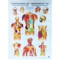 Fizioterápia VIII(TRIGGER PONTOK) - poszter